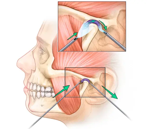 tmj-treatment-service