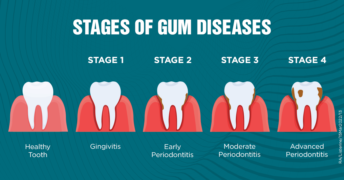 gum_disease