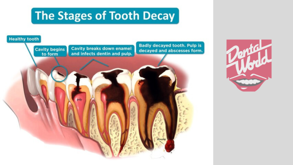 oral_health_blog_two