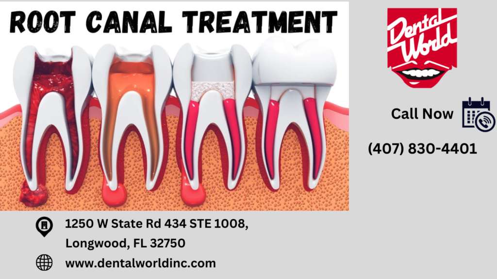 How do you choose the right dental office for your root canal Treatment ?