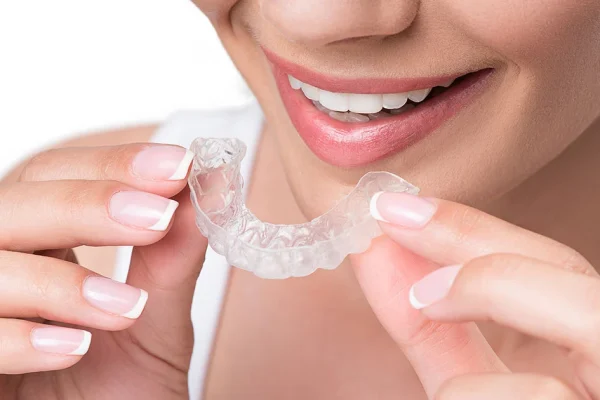 clear-aligners-service i