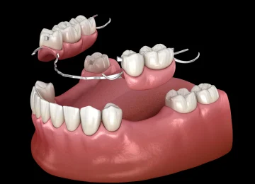 DENTURES & SNAP-ON DENTURES