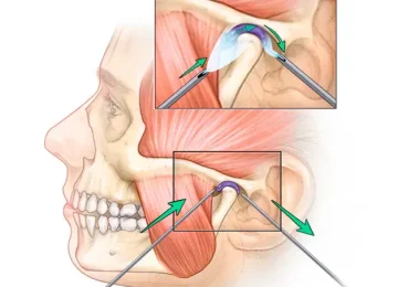 Tmj-treatment